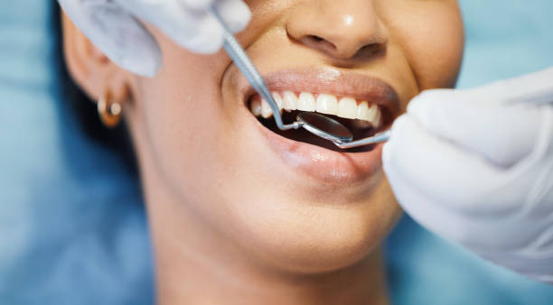 Best Mobile Emergency Dentist in Social Circle, GA